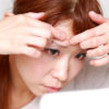 ニキビが感染するって知ってましたか？